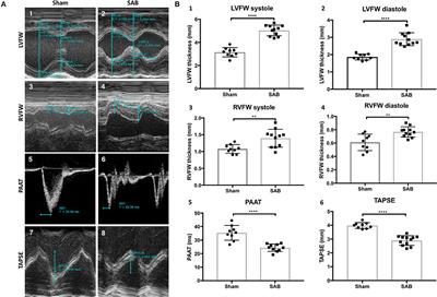 Biventricular Increases in Mitochondrial Fission Mediator (MiD51) and Proglycolytic Pyruvate Kinase (PKM2) Isoform in Experimental Group 2 Pulmonary Hypertension-Novel Mitochondrial Abnormalities